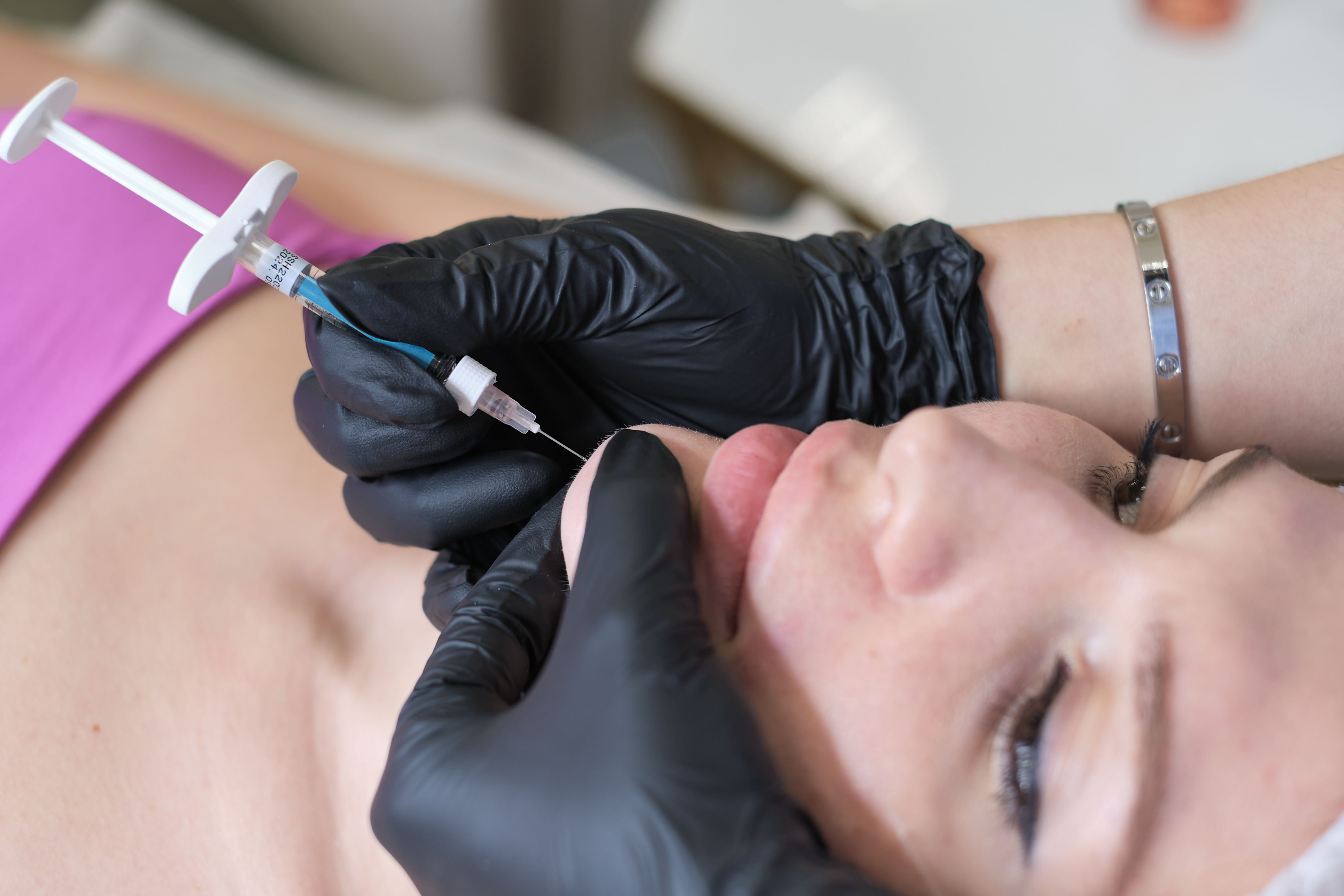 Dermal Fillers